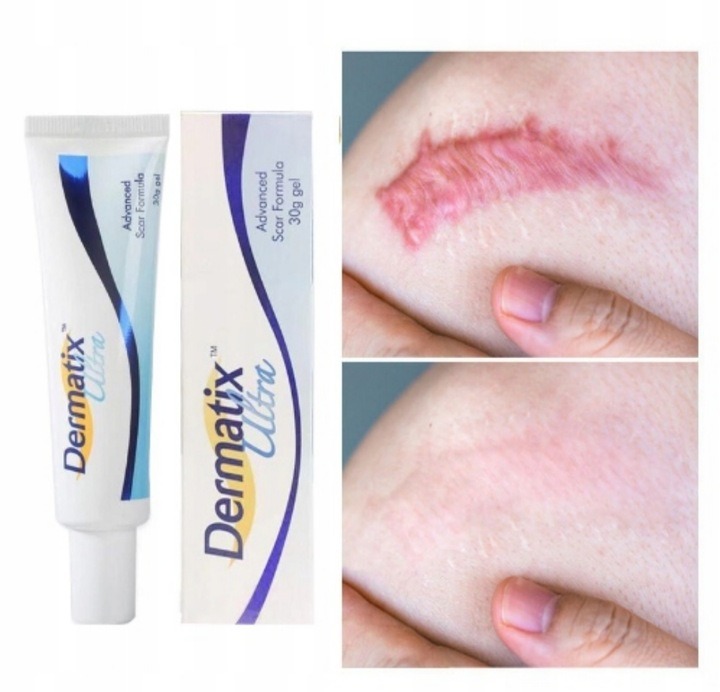 Dermatix Ultra silikónový gél na jazvy 15 g – liečba a prevencia hypertrofických a keloidných jaziev